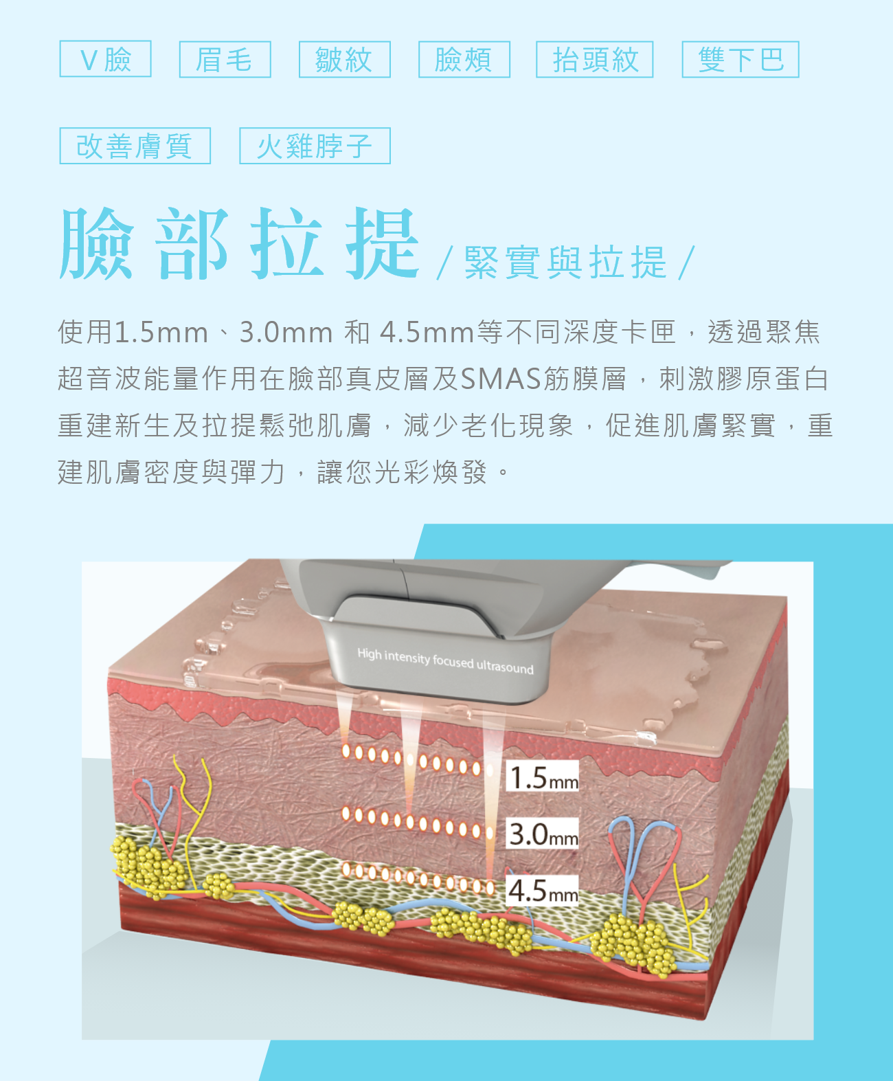 臉部拉提介紹